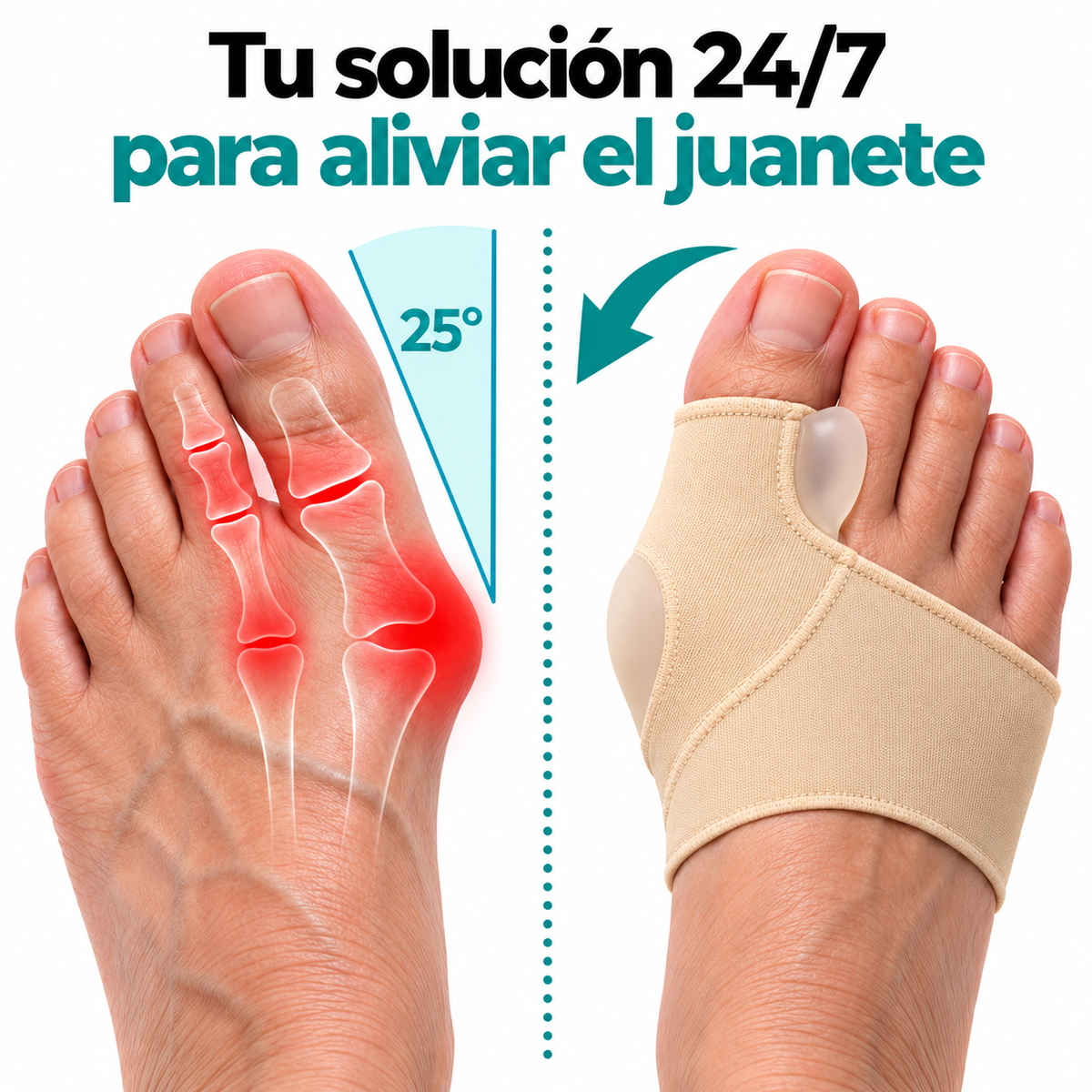 Corrector De Juanete Calcetin Protector